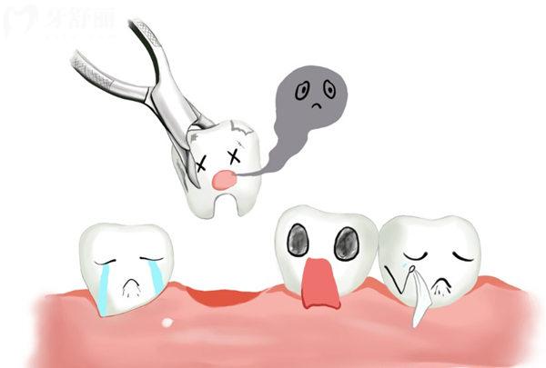 拔牙卡通圖