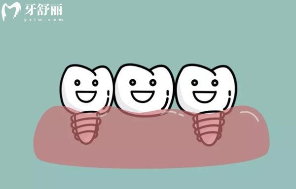 北**腔醫(yī)院瑞士種植牙價格表