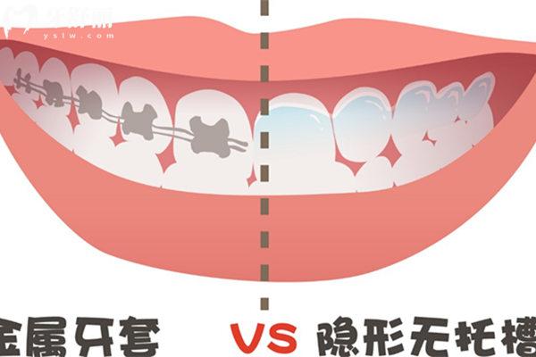 天津**矯正價(jià)格