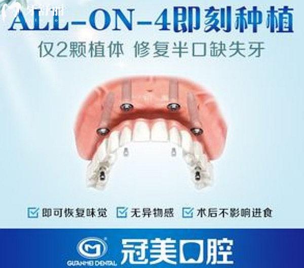 北京冠美口腔all-on-4種植手術(shù)