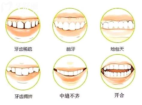 更新東莞**牙科2025收費(fèi)價(jià)目表,種植牙/牙齒矯正/補(bǔ)牙價(jià)格下調(diào)
