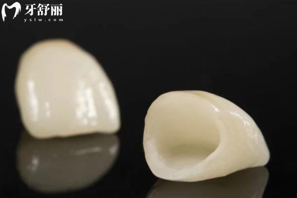 鑲牙