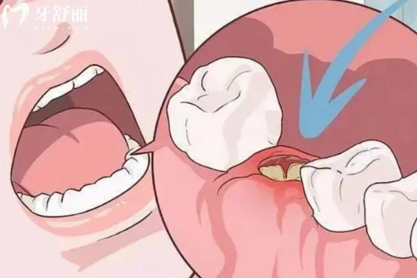 合肥咿博口腔醫(yī)院好不好？雙手奉上技術優(yōu)勢和乘車路線