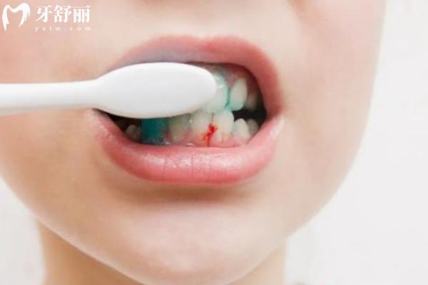牙周治療