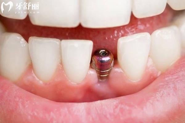 合肥肥東博愛口腔門診部