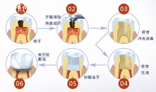 牙博士口腔醫(yī)院收費(fèi)貴嗎現(xiàn)在?2025年種植牙價(jià)格1980矯正4500靠譜又實(shí)惠