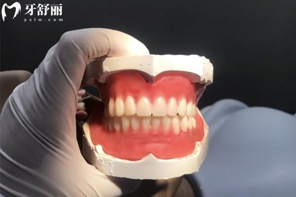 寧波好牙口腔鑲牙