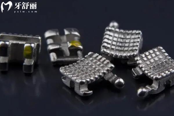 溧陽牙齒矯正