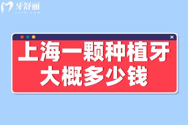 上海種植牙的價(jià)格大概是多少錢一顆