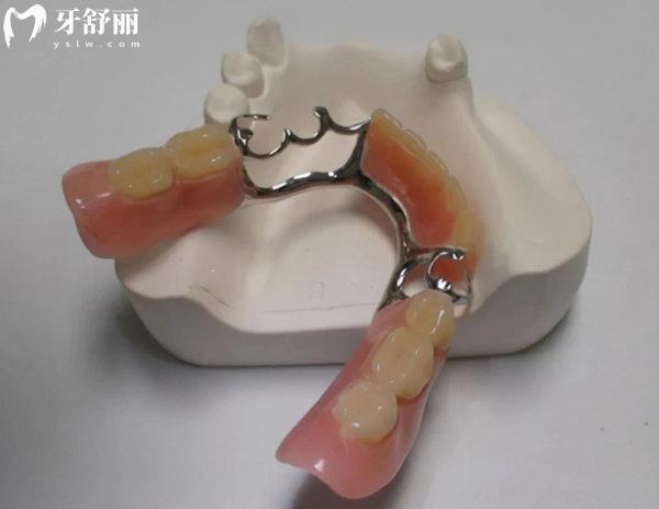 順義區(qū)醫(yī)院鑲牙多少錢