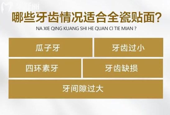 為什么要做牙貼面
