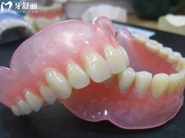 全口吸附性義齒