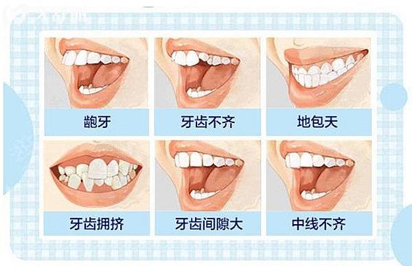秦皇島第 一醫(yī)院口腔科整牙價格表