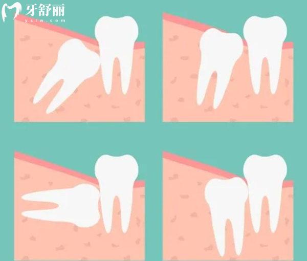 秦皇島第 一醫(yī)院口腔科拔牙價格表