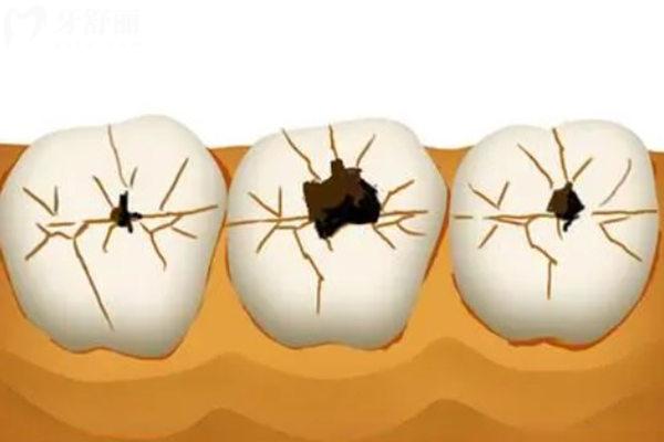 秦皇島第 一醫(yī)院口腔科補(bǔ)牙價格表
