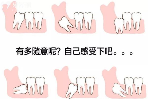 智齒的生長很隨意