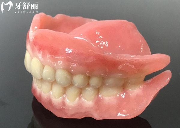 吸附性義齒