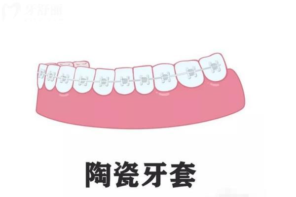 吳江正規(guī)口腔醫(yī)院價(jià)格收費(fèi)標(biāo)準(zhǔn)