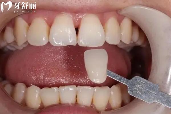 高郵牙科醫(yī)院收費(fèi)標(biāo)準(zhǔn)