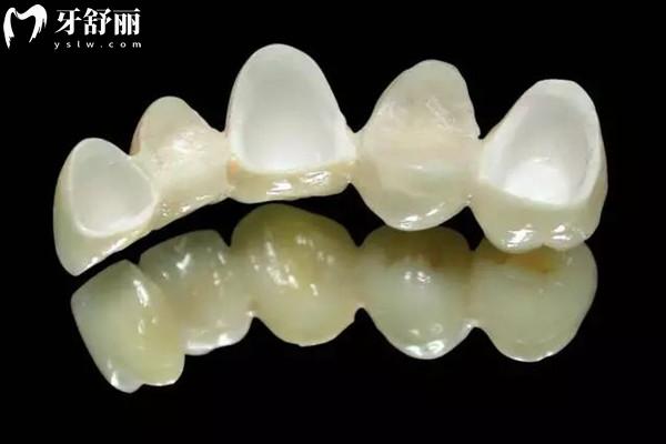 雅安正規(guī)牙科收費(fèi)標(biāo)準(zhǔn)