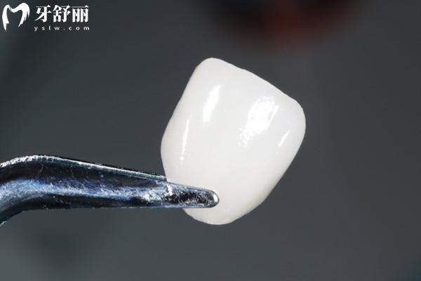 西昌看牙收費標準