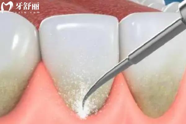 新余現(xiàn)代口腔醫(yī)院怎么樣