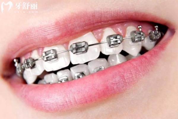 2024年新版蘇州牙科價(jià)目表