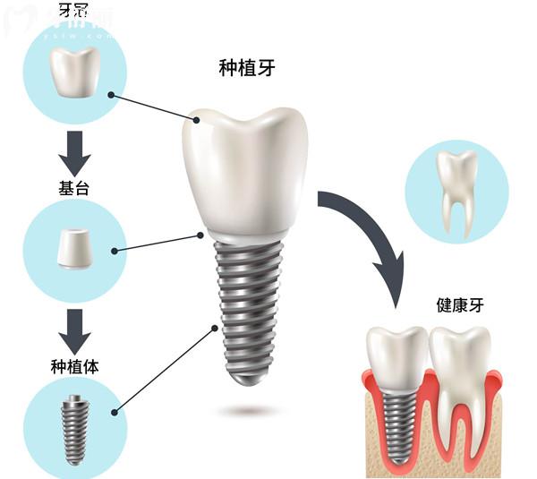 杭州西湖區(qū)牙科醫(yī)院收費(fèi)標(biāo)準(zhǔn)