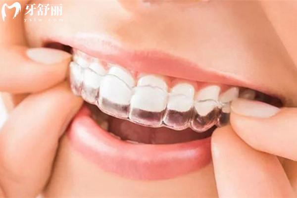 杭州西湖區(qū)牙科醫(yī)院收費(fèi)標(biāo)準(zhǔn)
