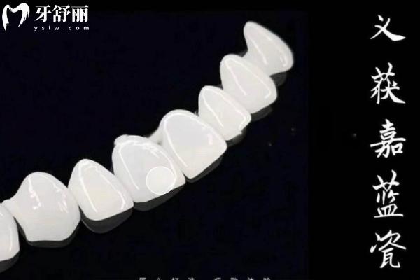 義獲嘉藍(lán)瓷貼面