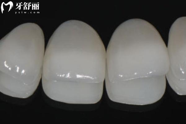 義獲嘉藍(lán)瓷貼面