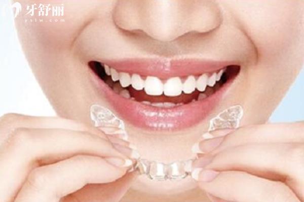 牙套價(jià)目表