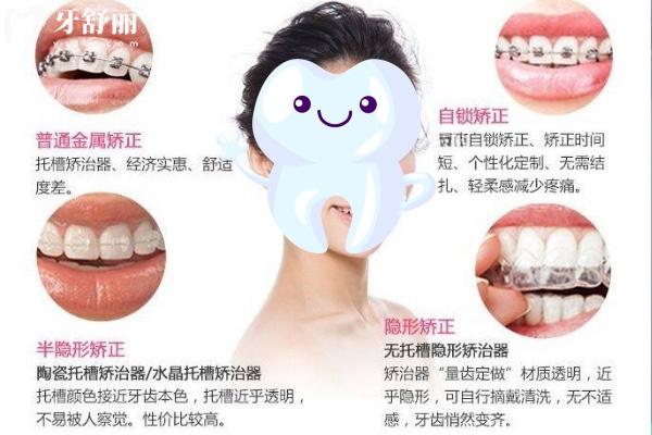 長春牙齒矯正多少錢