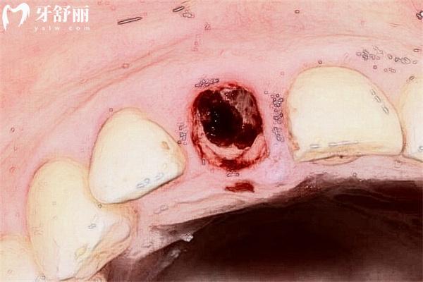白城正規(guī)口腔醫(yī)院拔牙多少錢