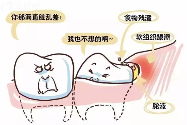 牙齦發(fā)炎腫痛怎么消 炎快