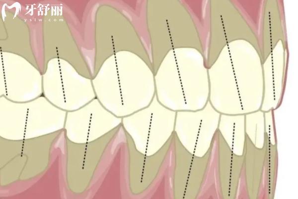 牙齒用手晃有點(diǎn)松動(dòng)正常嗎？會(huì)自己長(zhǎng)好嗎？
