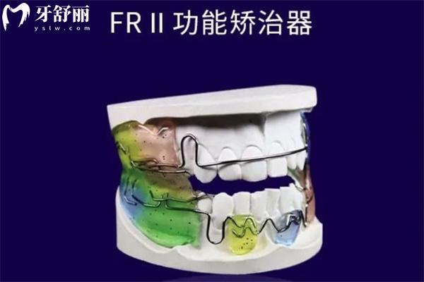 Frankel II矯治器