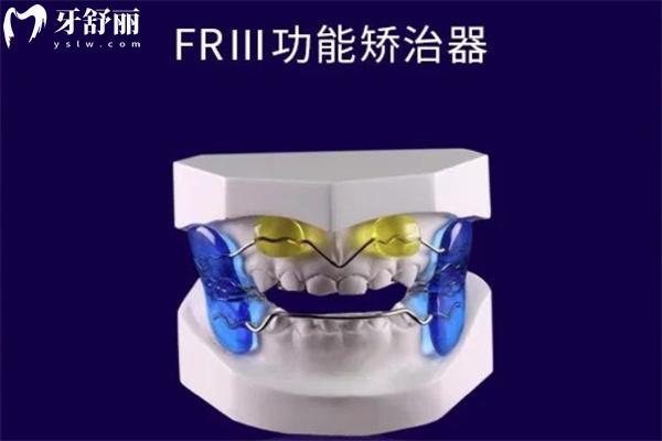 FR-III型矯治器
