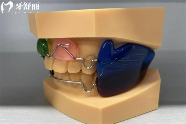 Frankel功能矯治器