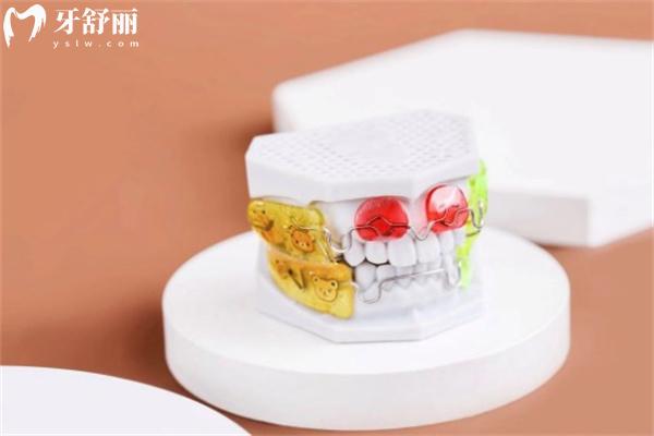 Frankel功能矯治器