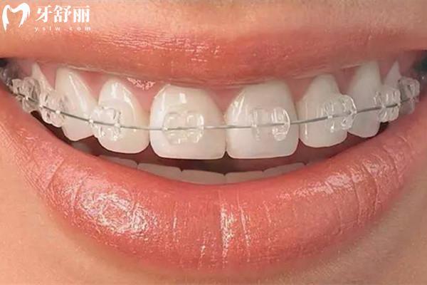 成都比較出名的正畸醫(yī)生排名榜