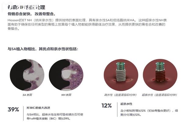 美國皓圣ET種植體表面處理技術(shù)特色