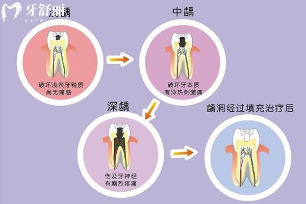 諸暨看牙收費(fèi)標(biāo)準(zhǔn)