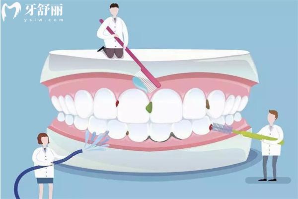 一般洗牙需要多長(zhǎng)時(shí)間?多少錢(qián)?