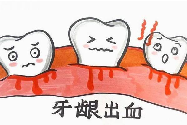 糖尿病牙周炎怎么治療有效