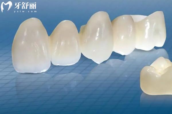 涼山州看牙收費標準