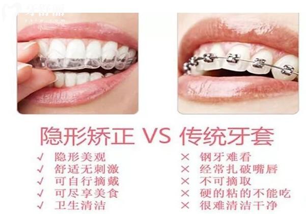 北京徐寶華矯正牙齒多少錢