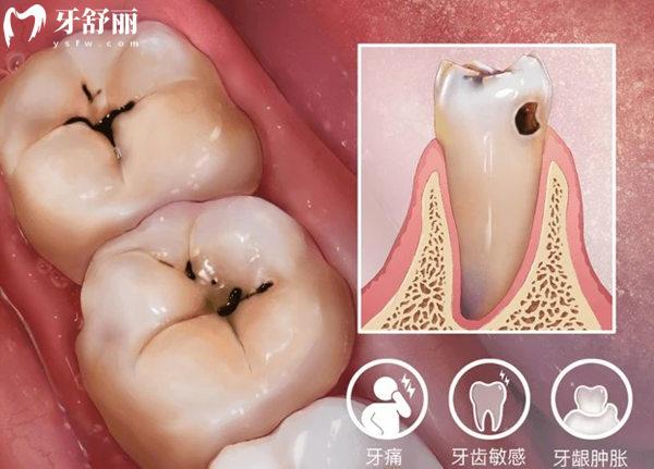 石家莊牙科醫(yī)院補牙多少錢？收費標準99-800元左右