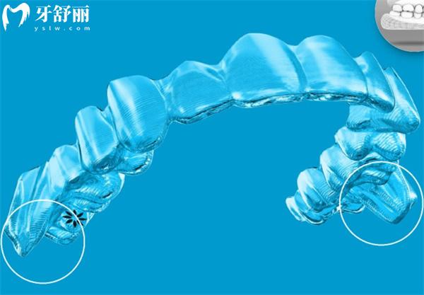 佳美口腔醫(yī)院牙齒矯正價(jià)格表