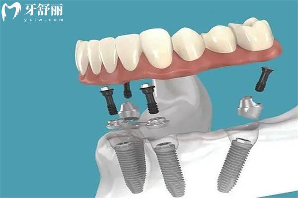 呼和浩特看牙哪家可以報<span style=